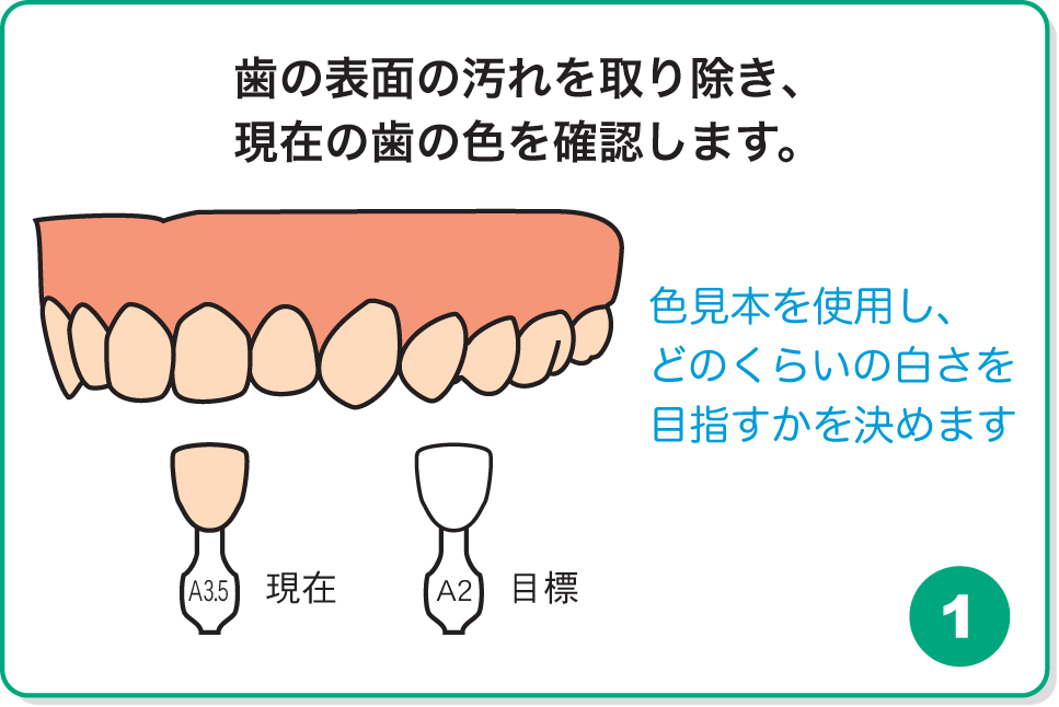 歯の表面の汚れを取り除き、現在の歯の色を確認します