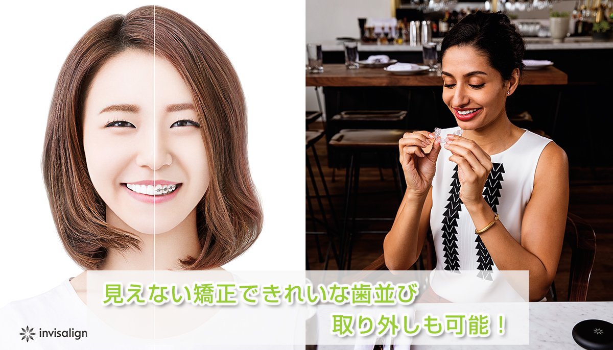 栃木県足利市の歯医者 | 見えない矯正で綺麗な歯並び取り外しも可能